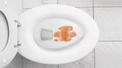 A széklet képet adhat a szervezetben zajló eseményekről, figyeljünk rá