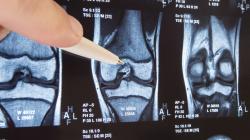 Porckopás a térdben: mikrofonnal könnyebb diagnosztizálni